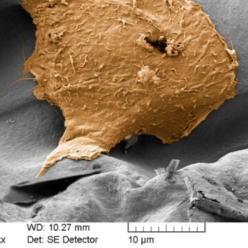 Mesenchymal stem cell (MSC) adhering on a collagen-glycosaminoglycan biomaterial
